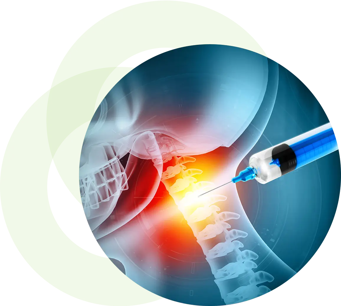 Syringe injecting neck pain relief.