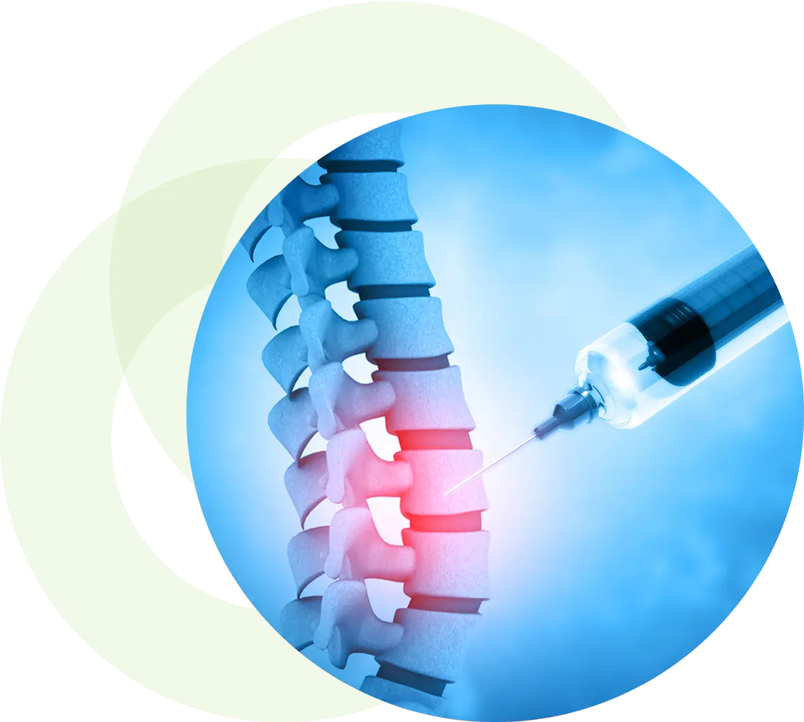 Syringe injecting spinal column pain relief.