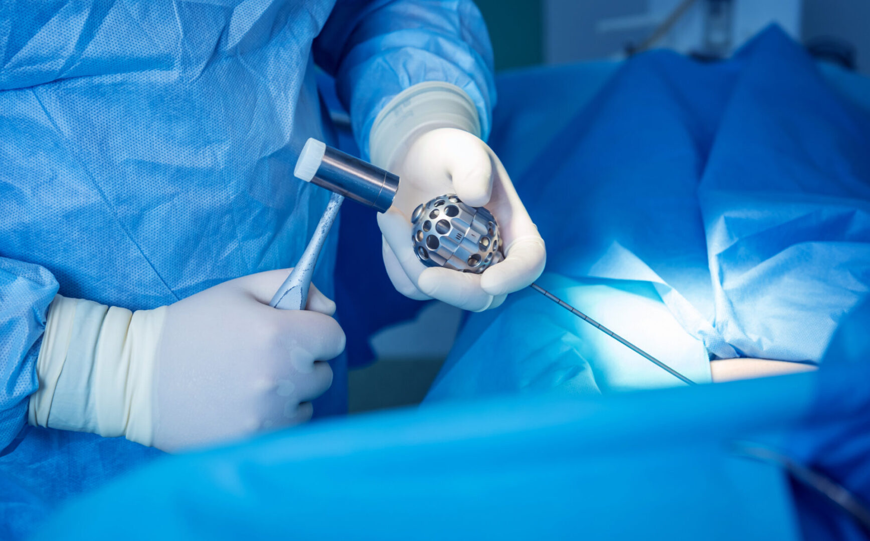 Surgeon performs endoscopic microdiscectomy of herniated intervertebral disc